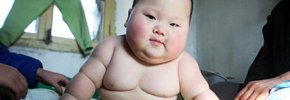 رشد غیر طبیعی پستانها در کودکان چینی/ دکتر پرویز قدیریان