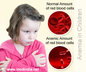 anemia-in-children