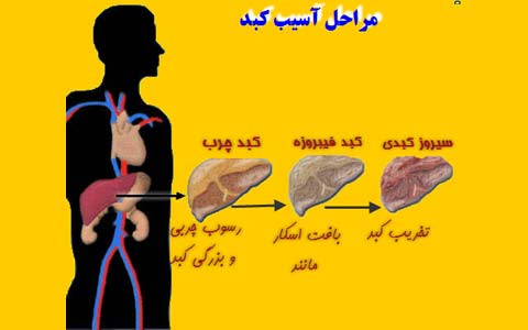 سیروز/دکتر عطا انصاری